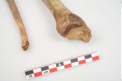 Foto von Menschenknochen (NHMW-PRAE-026362a)